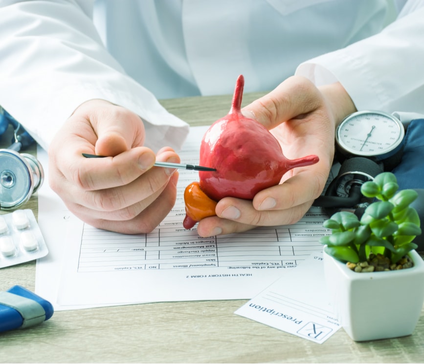 Cálculo Urinário – Entenda as pedras nos rins